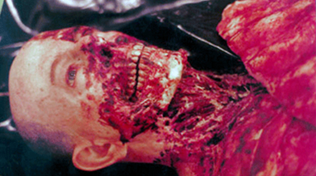  The Xfiles (Optic Nerve) 